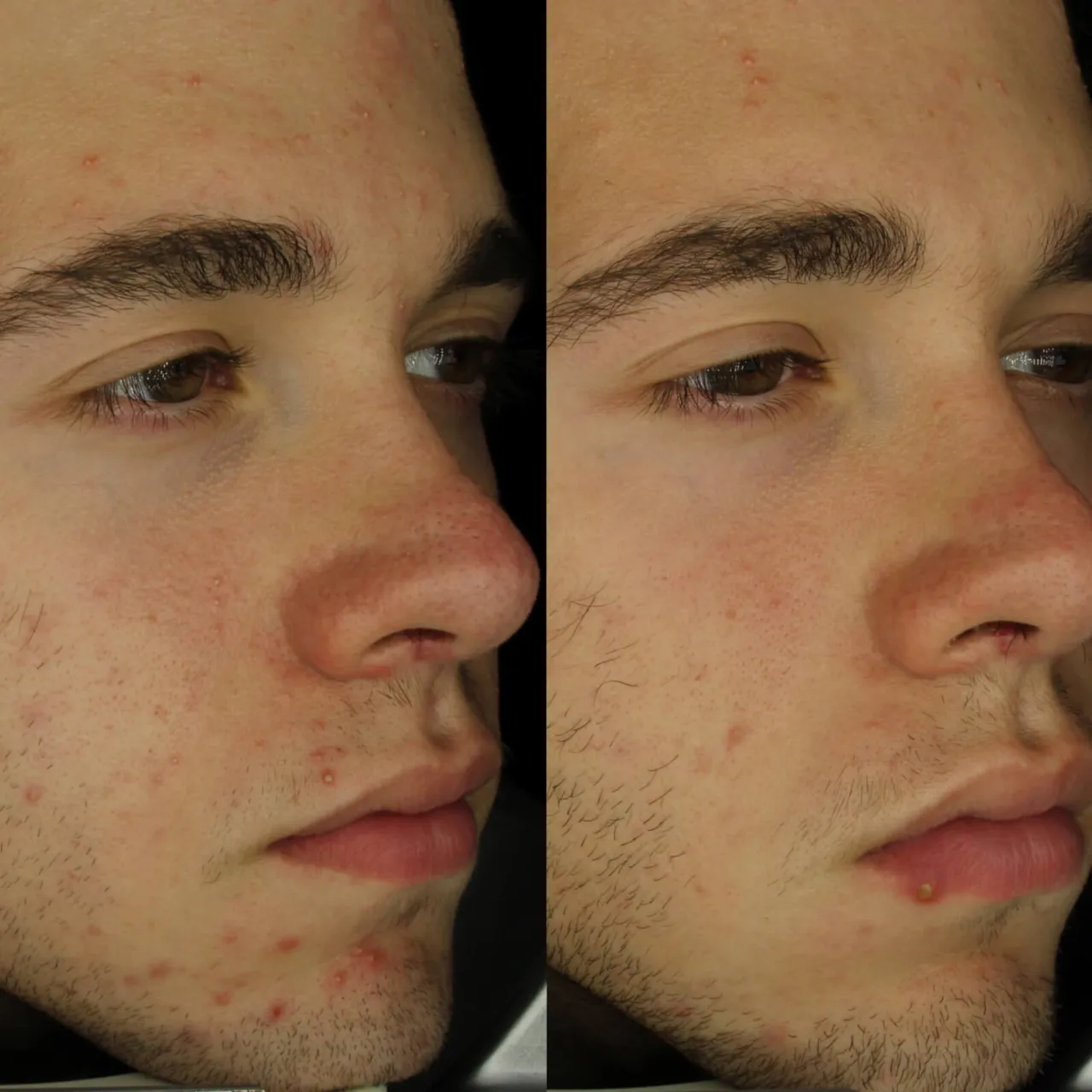 AMELIORATE Transforming Clarity Facial Serum 30ml